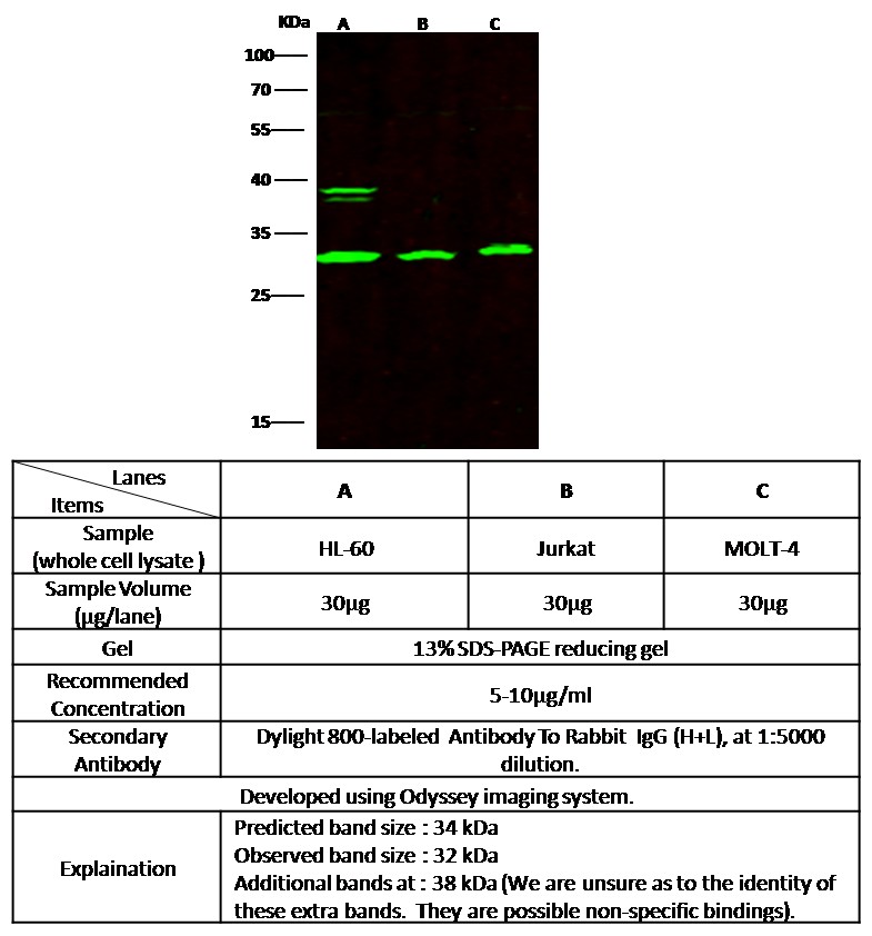 Recombinant BLyS/TNFSF13B/BAFF Monoclonal Antibody - small - 2
