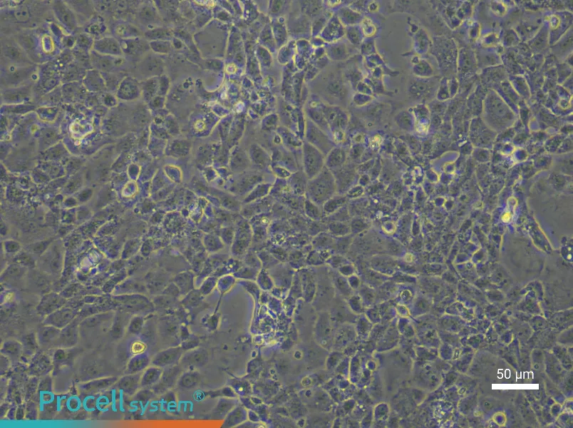 Rat Coronary Artery Endothelial Cells - 4