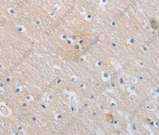 SLC16A7 Polyclonal Antibody - 3