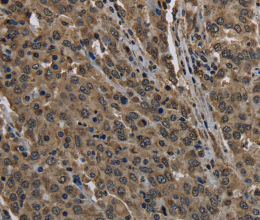 HIST1H2AH Polyclonal Antibody - 3