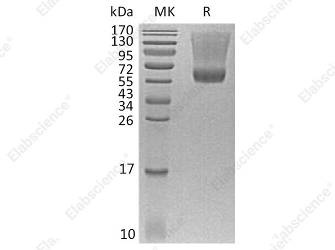 Recombinant Human Renin Protein (His Tag) - 1