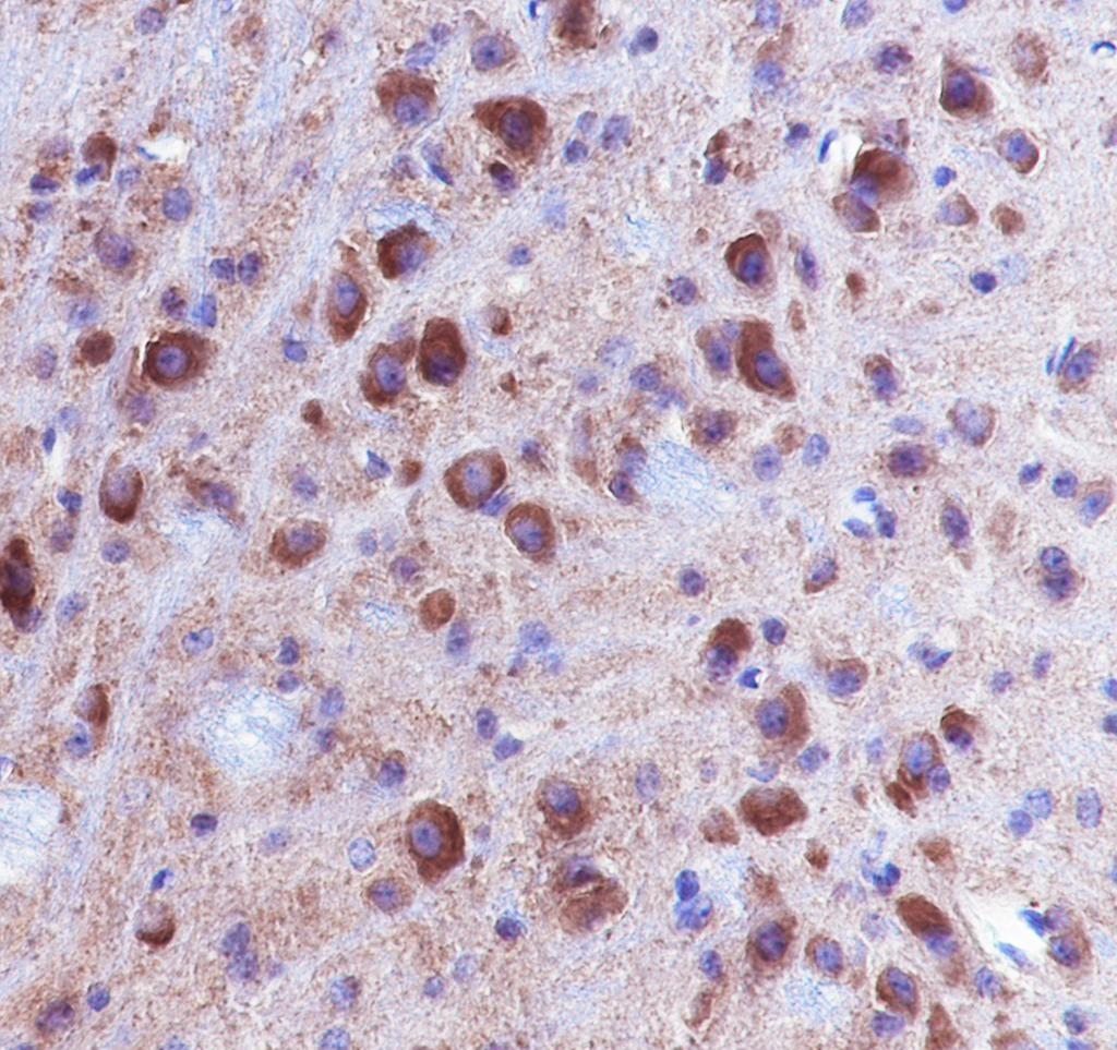 Recombinant DNAJC6 Monoclonal Antibody - small - 6