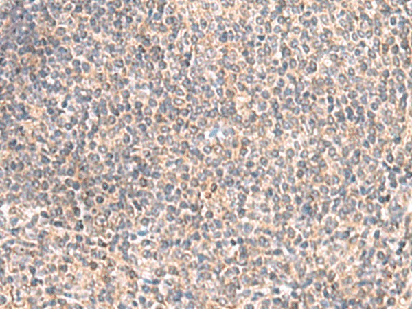 Immunohistochemistry of paraffin-embedded Human tonsil tissue  using GIMAP2 Polyclonal Antibody at dilution of 1:55(?200)