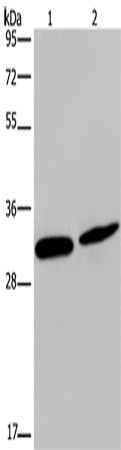 Western Blot analysis of Mouse skin tissue and Hela cell using GJB4 Polyclonal Antibody at dilution of 1:200