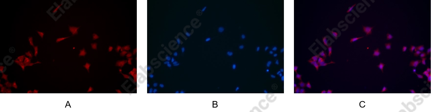 Recombinant NF-κB p65 Monoclonal Antibody - 5
