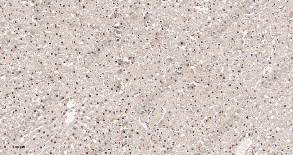 Recombinant Glucocorticoid Receptor Monoclonal Antibody - 3