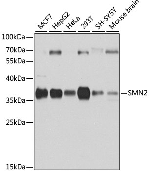 Western blot analysis of extracts of various cell lines using SMN2 Polyclonal Antibody at 1:1000 dilution.