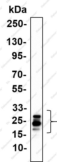 Recombinant VHL Monoclonal Antibody - 1