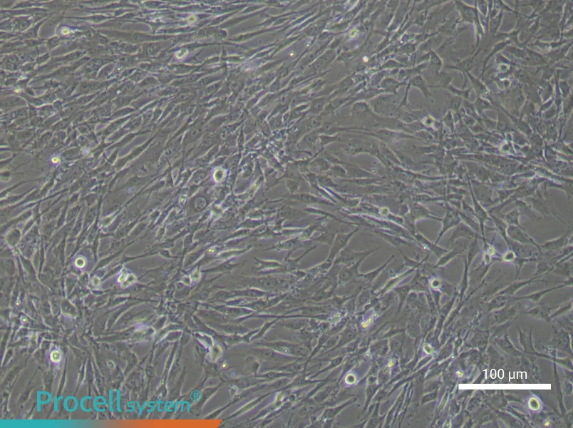 Human Bone Marrow Mesenchymal Stem (Primary cell immortalization) Cell Complete Medium - 1