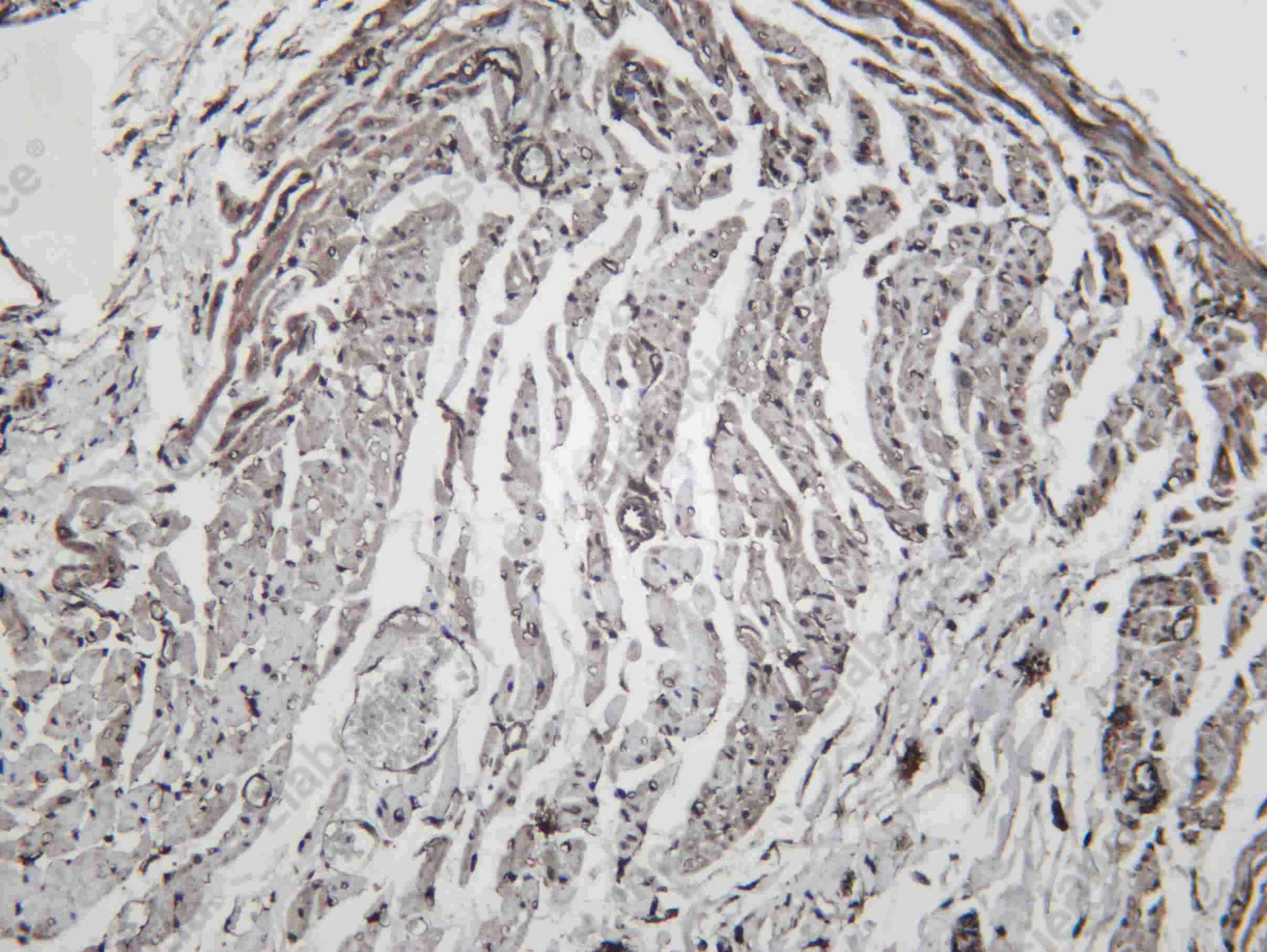 Recombinant VPS4A Monoclonal Antibody - 3