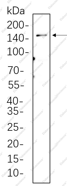 Recombinant LATS1 Monoclonal Antibody - 1