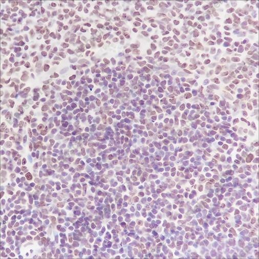 Recombinant NPM1 Monoclonal Antibody - 4