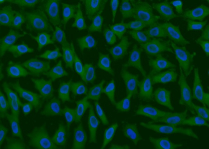 GPX4 Monoclonal Antibody - small - 1