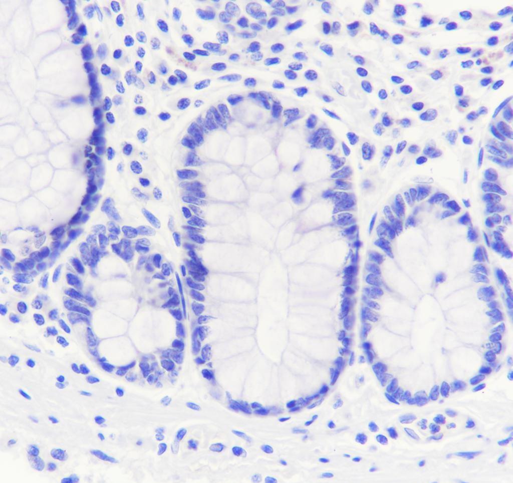 Recombinant MYH7 Monoclonal Antibody - small - 3