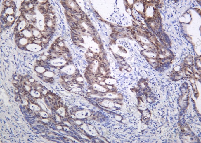 Recombinant CDX2 Monoclonal Antibody - 1