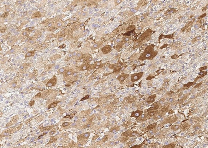 Recombinant CSEN/calsenilin/KCNIP3 Monoclonal Antibody - small - 1