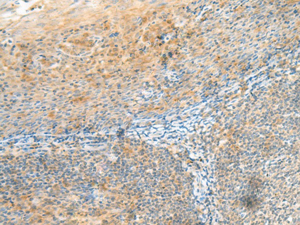 Immunohistochemistry of paraffin-embedded Human tonsil tissue  using CLEC3B Polyclonal Antibody at dilution of 1:90(?200)