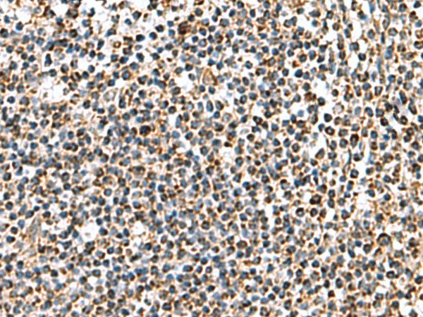 Immunohistochemistry of paraffin-embedded Human tonsil tissue  using AP1S3 Polyclonal Antibody at dilution of 1:70(?200)