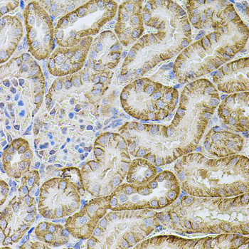 Immunohistochemistry of paraffin-embedded Mouse kidney using CDH16 Polyclonal Antibody at dilution of 1:100 (40x lens).