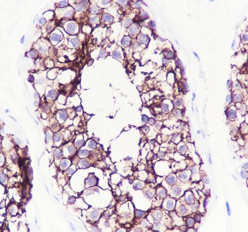 Recombinant SLC7A5/LAT1 Monoclonal Antibody - small - 3