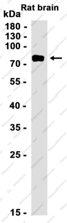 Recombinant Phospho-PKC alpha (Ser657) Monoclonal Antibody - 2