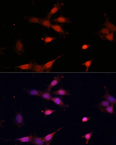 Immunofluorescence analysis of NIH-3T3 cells using Bcl-2 Polyclonal Antibody at dilution of  1:100 (40x lens). Blue: DAPI for nuclear staining.