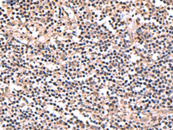 Immunohistochemistry of paraffin-embedded Human tonsil tissue  using PER3 Polyclonal Antibody at dilution of 1:70(?200)