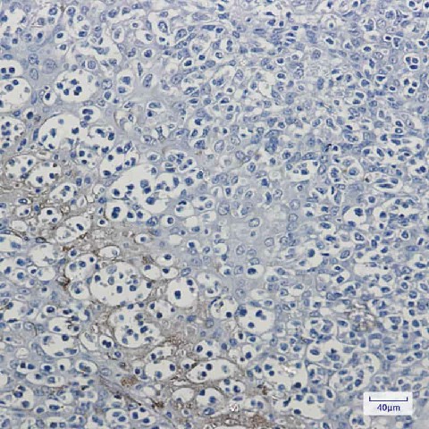 Immunohistochemistry of RKIP in paraffin-embedded Human tonsil using RKIP Rabbit mAb at dilution 1:50