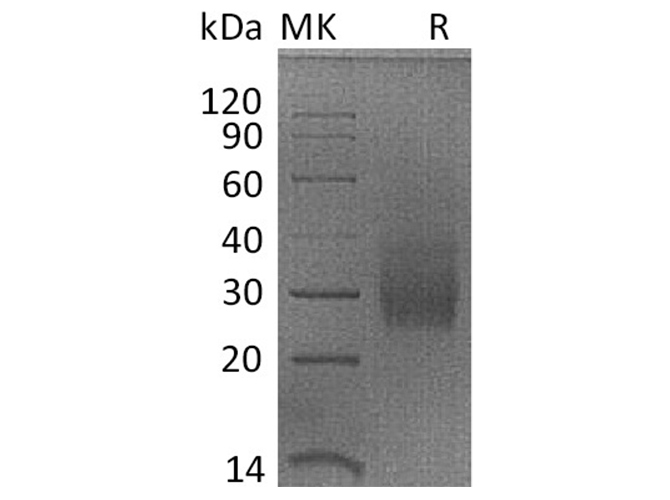 Recombinant Rhesus macaque HVEM/TNFRSF14/CD270 Protein (His Tag)