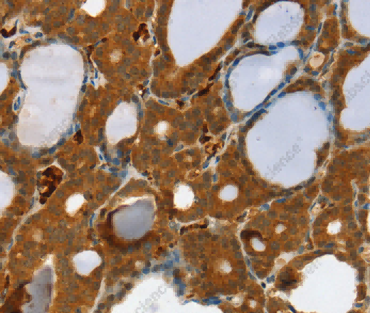 RAB27A Polyclonal Antibody - 2