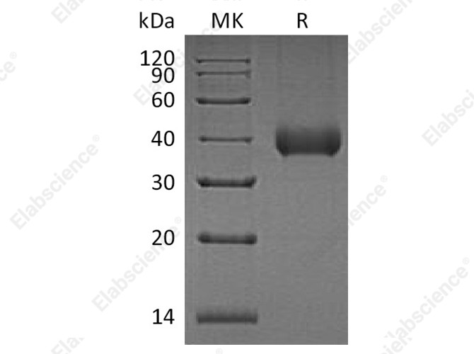 Recombinant Human Kallikrein 11/KLK11 Protein (His Tag) - 1