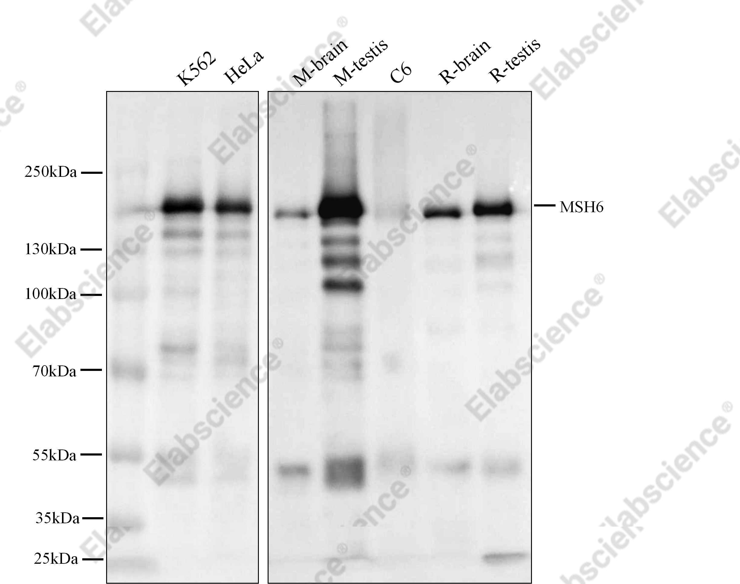 Recombinant MSH6/GTBP Monoclonal Antibody - 4