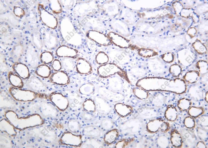 Recombinant PAI-1 Monoclonal Antibody - 1