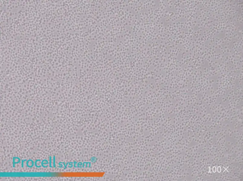 SU-DHL-8 Cell Complete MediumSU-DHL-8 Cell Complete Medium - 2