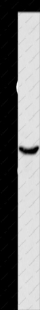 HSP40 Polyclonal Antibody - 1
