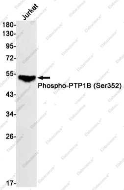 Recombinant Phospho-PTP1B (Ser352) Monoclonal Antibody - 1