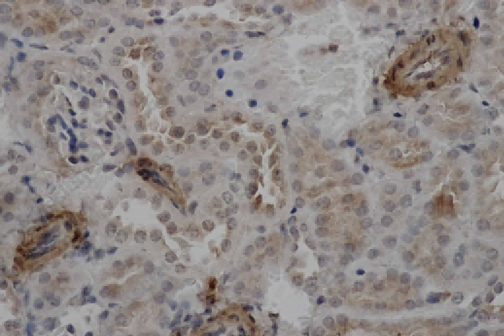 ACTA2 Polyclonal Antibody - 2