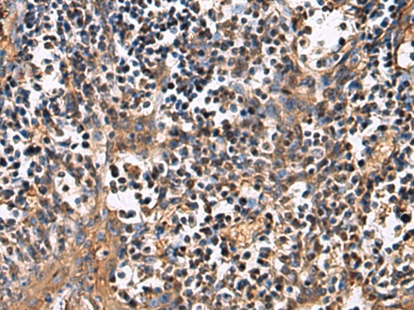 Immunohistochemistry of paraffin-embedded Human tonsil tissue  using ECM1 Polyclonal Antibody at dilution of 1:25(?200)