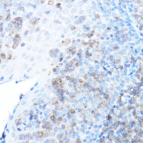 Immunohistochemistry of paraffin-embedded human tonsil using ULBP1 Polyclonal Antibody at dilution of 1:500 (40x lens).Perform high pressure antigen retrieval with 10 mM citrate buffer pH 6.0 before commencing with IHC staining protocol.