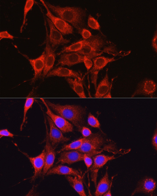 Immunofluorescence analysis of PC-12 cells using [KO Validated] Glutamine Synthetase Polyclonal Antibody at dilution of 1:100 (40x lens). Blue: DAPI for nuclear staining.