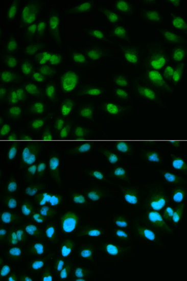 Immunofluorescence analysis of HeLa cells using MCM7 Polyclonal Antibody