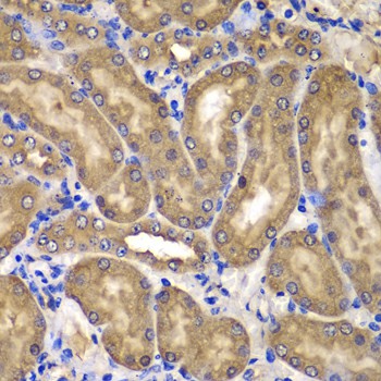Immunohistochemistry of paraffin-embedded mouse kidney using NME2/NM23B Polyclonal antibody at dilution of 1:100 (40x lens).Perform microwave antigen retrieval with 10 mM PBS buffer pH 7.2 before commencing with IHC staining protocol.