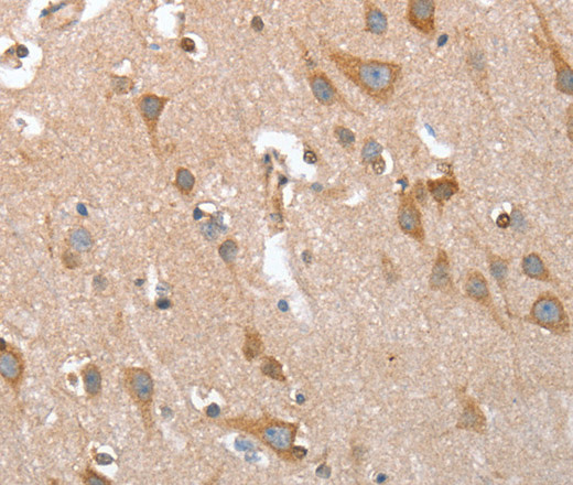 Immunohistochemistry of paraffin-embedded Human brain  using TP53BP2 Polyclonal Antibody at dilution of 1:35