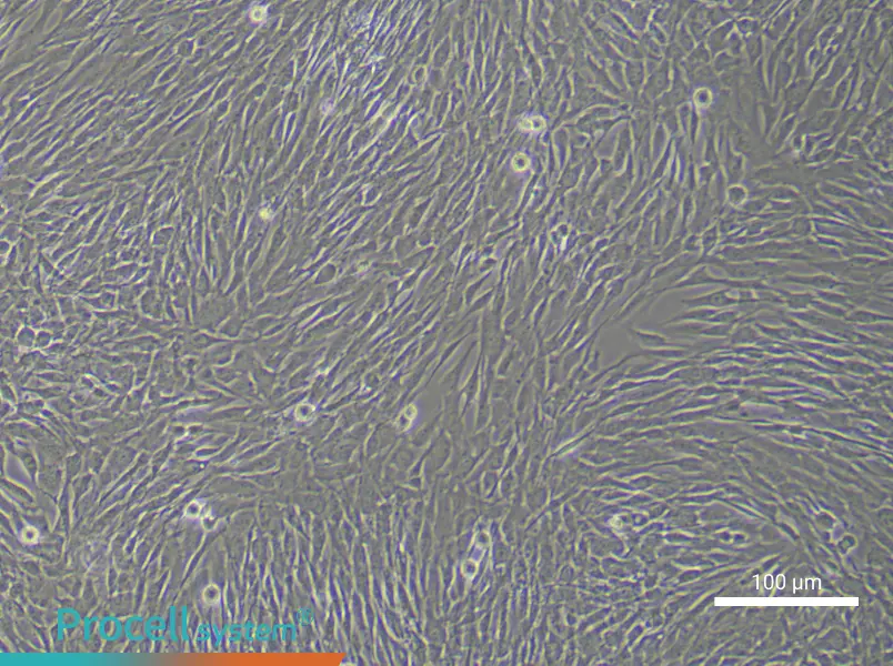 Human Cardiac Fibroblast (Primary cell immortalization) Complete Medium - 1