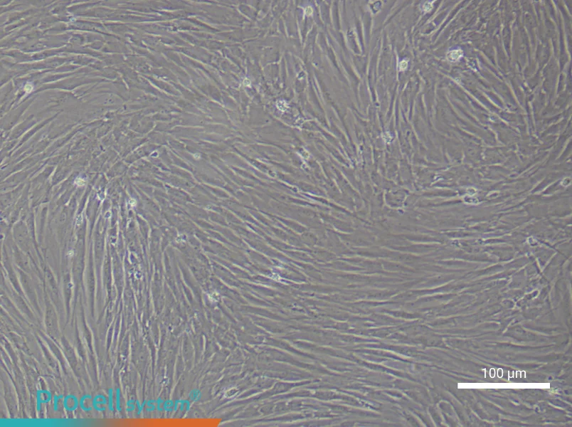 Human Pulmonary Artery Smooth Muscle Cell Complete Medium - 3