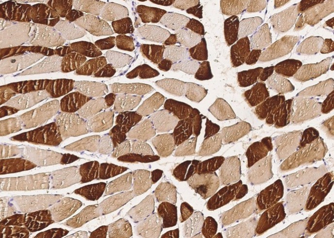 Recombinant ENO3/beta-enolase Monoclonal Antibody - small - 1