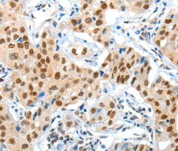 APPL1 Polyclonal Antibody - 3