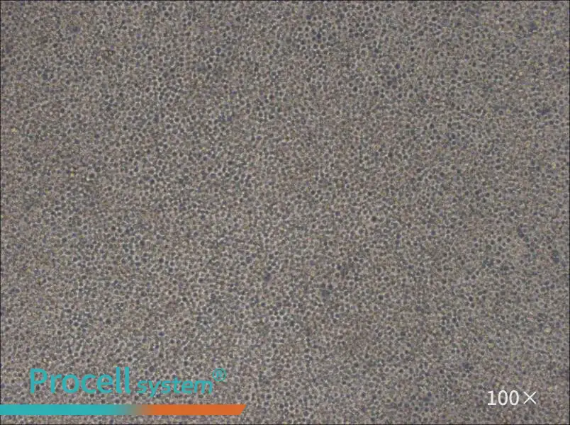 MOLM-13 Cell Complete Medium - 2