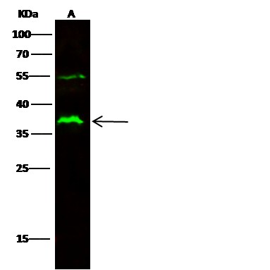 Recombinant CD32a/FCGR2A Monoclonal Antibody-searchlist-1