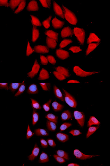 Immunofluorescence analysis of U2OS cells using PSMA6 Polyclonal Antibody